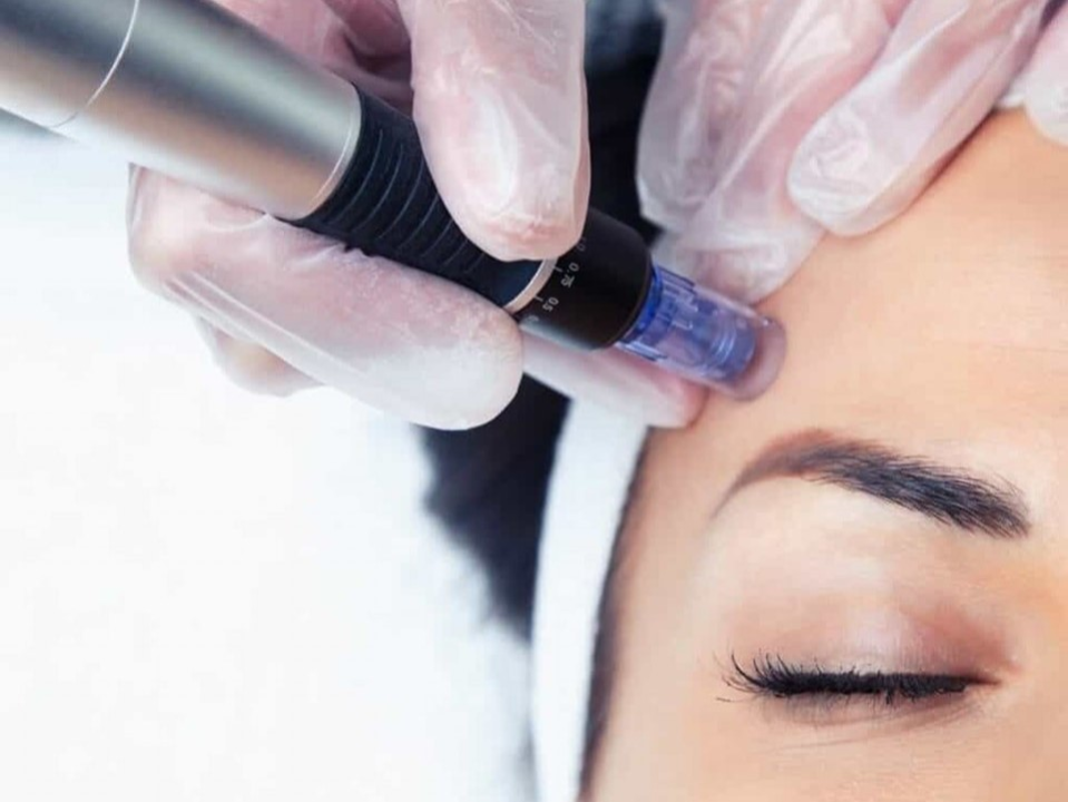 FOTO Poliklinika Gemini: Pomladite svoju kožu uz popust od 20 posto