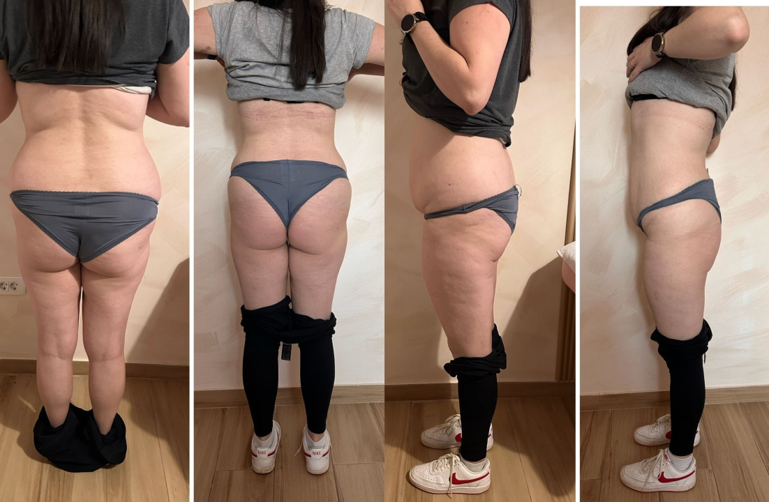 FOTO Tražite motivaciju nakon blagdana? Beauty Clinic by Tamara donosi izazov uz koji se vraćate u formu!