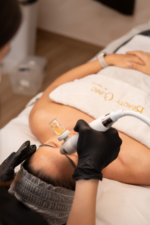 FOTO U Beauty Clinic by Tamara ljeto nije prepreka za lasersku epilaciju!