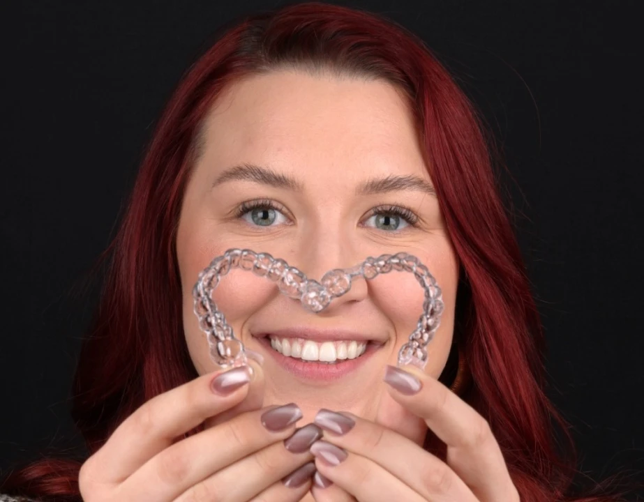 FOTO Transformirajte osmijeh prozirnim alignerima u Dental centru Dubravica! 	