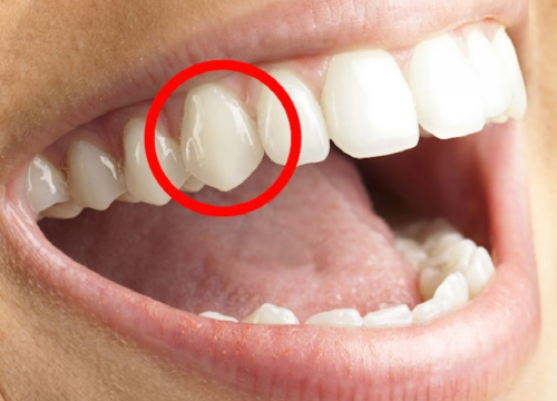 Uz Bio2You pastu za zube vaši će zubi biti zdravi i bijeli!