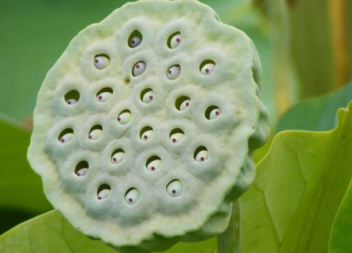 Mnogi niti ne znaju da imaju ovu fobiju, jeste li među njima?