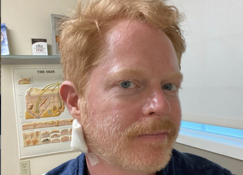 Jesse Tyler Ferguson operiran: Uklonili su mi 'malo raka', ok sam