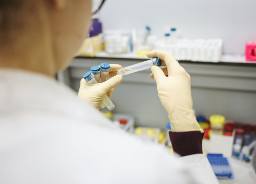 Najduži slučaj zaraze: Muškarac deset mjeseci bio pozitivan na covid-19