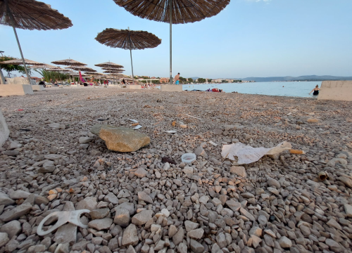 Fotografija 2 - Bez pretjerivanja, Rezalište izgleda odvratno. Kako itko može raširiti šugaman po ovome?