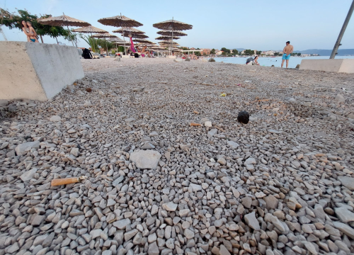 Fotografija 3 - Bez pretjerivanja, Rezalište izgleda odvratno. Kako itko može raširiti šugaman po ovome?