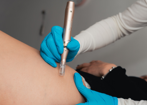 Fotografija 26 - Beauty bar Tamara časti vas vrhunskim popustima na brojne tretmane za uljepšavanje i njegu tijela!