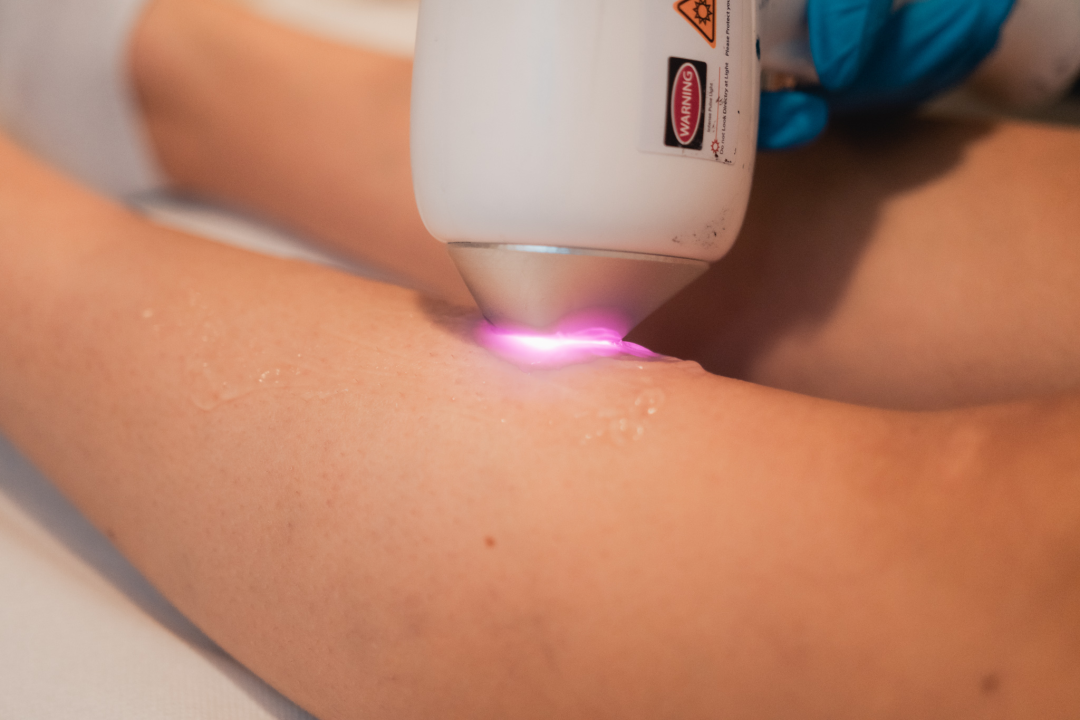 Povodom Dana žena Beauty Bar Tamara vas časti popustom na najtraženije tretmane!