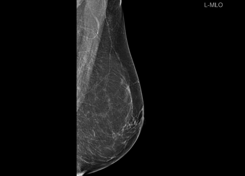 Fotografija 5 - Poliklinika Affidea Vita svojim pacijenticama nudi besplatne preglede dojki!