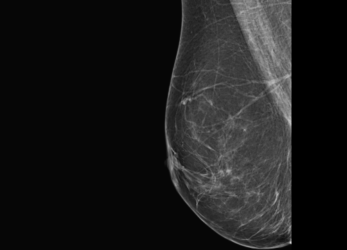 Fotografija 6 - Poliklinika Affidea Vita svojim pacijenticama nudi besplatne preglede dojki!