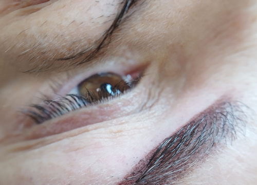 Fotografija 4 - Riješite se uraslih noktiju uz medicinsku pedikuru!