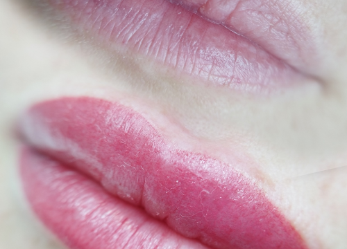 Fotografija 8 - Riješite se uraslih noktiju uz medicinsku pedikuru!