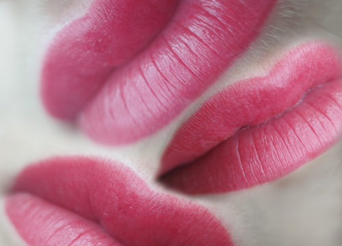 Fotografija 16 - Riješite se uraslih noktiju uz medicinsku pedikuru!