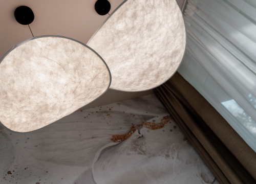 Fotografija 13 - Za ljepotu bez fil(t)era posjetite Bani modernu estetiku!