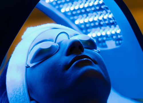 Fotografija 28 - Za ljepotu bez fil(t)era posjetite Bani modernu estetiku!