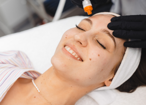 Fotografija 11 - Osvježite svoje lice uz revolucionarni tretman u Be You salonu!