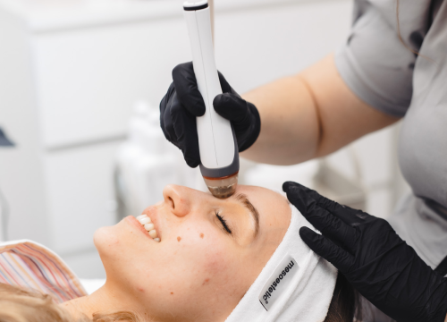 Fotografija 18 - Osvježite svoje lice uz revolucionarni tretman u Be You salonu!