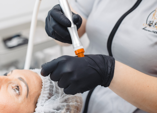 Fotografija 21 - Osvježite svoje lice uz revolucionarni tretman u Be You salonu!