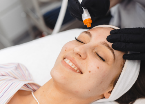 Osvježite svoje lice uz revolucionarni tretman u Be You salonu!