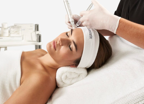 Fotografija 27 - Sorriso Beauty Centar časti popustima na vrhunske pakete tretmana!