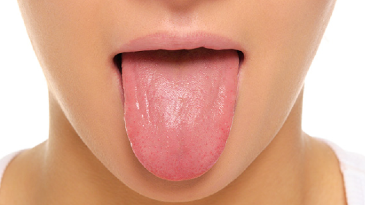 Ovaj simptom u ustima može ukazivati na jednu od pet ozbiljnih bolesti