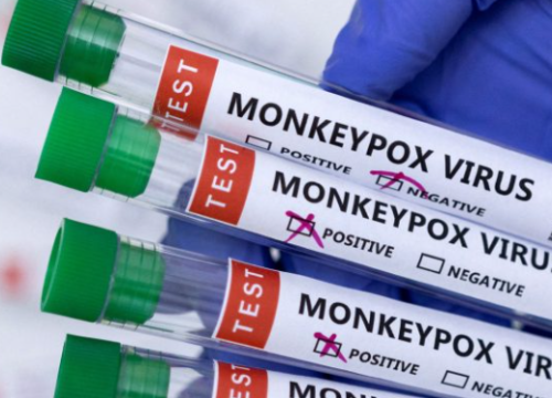 Zabilježen prvi slučaj majmunskih boginja u Europi