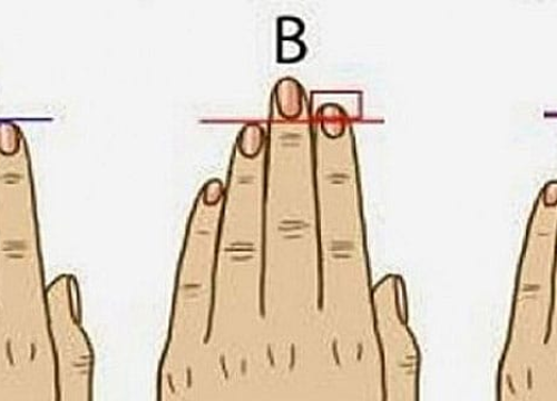 Usporedite dužinu svojih prstiju i saznajte što to govori o karakteru i zdravlju