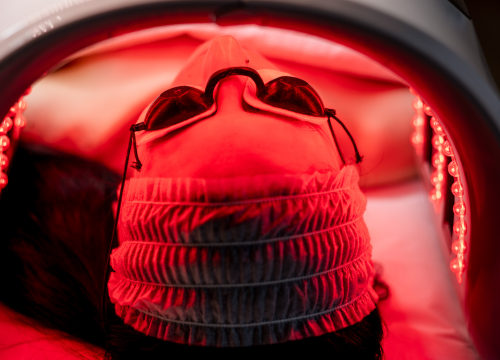 Fotografija 14 - Do ljeta bez dlačica uz novi laser iz Beauty Clinic by Tamara!