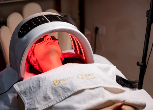 Fotografija 26 - Do ljeta bez dlačica uz novi laser iz Beauty Clinic by Tamara!