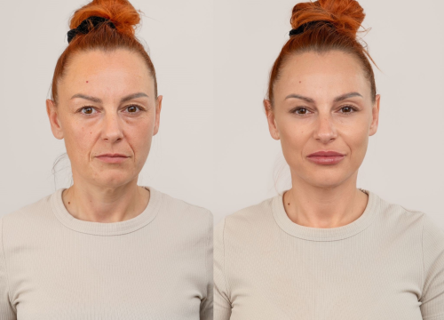Fotografija 7 - Završen je makeover Beauty salona Darling, pogledajte rezultate!