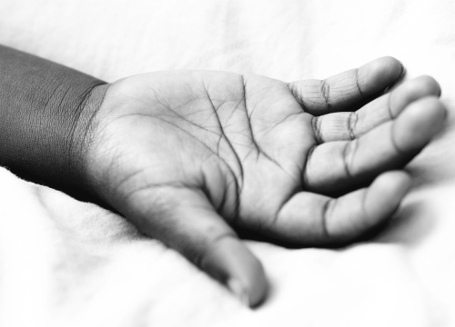 Misterij srebrnih ruku kod ovog muškarca i dalje neriješen