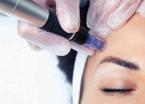 Fotografija 1 - FOTO Poliklinika Gemini: Pomladite svoju kožu uz popust od 20 posto