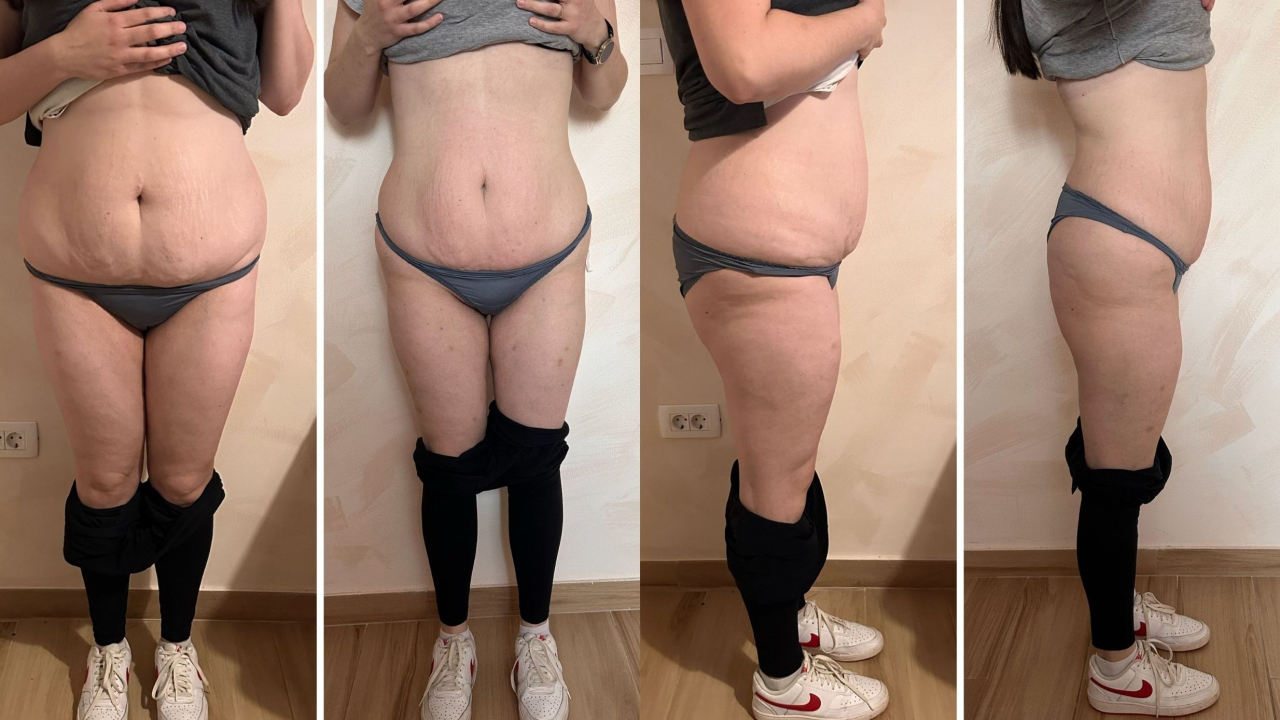 Skinite do 10 kilograma u 6 tjedana uz Beauty Clinic by Tamara