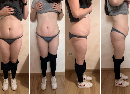 Skinite do 10 kilograma u 6 tjedana uz Beauty Clinic by Tamara