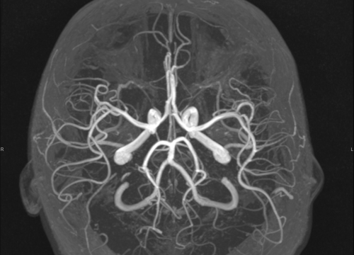 Fotografija 6 - FOTO Naručite se na rendgen, ultrazvuk, CT ili MR u Poliklinici Affidea Vita!